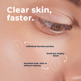 Clear Skin Spot Dots 6-Pack