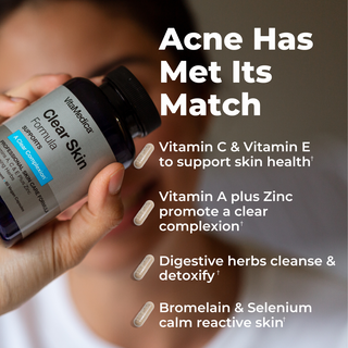 Clear Skin Formula Acne Nutraceutical