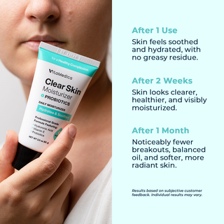 Clear Skin Probiotic Facial Moisturizer