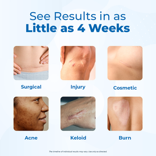 Advanced Scar Gel + Peptides